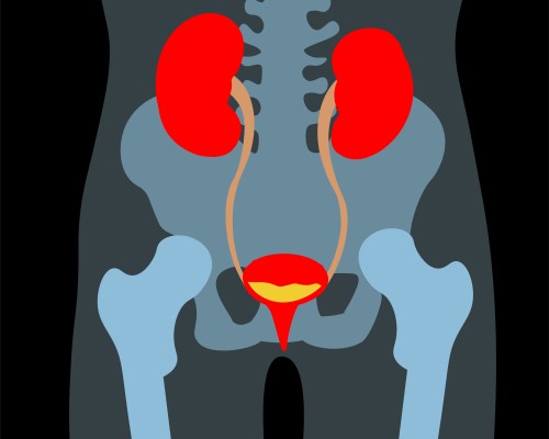 An X ray view showing the kidneys and bladder
