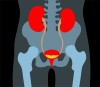 What is a Mitrofanoff Procedure, and is it Worth it? | Spinal Cord ...